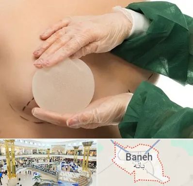 جراحی پروتز سینه در بانه