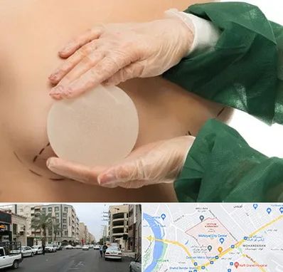 جراحی پروتز سینه در زیتون کارمندی اهواز