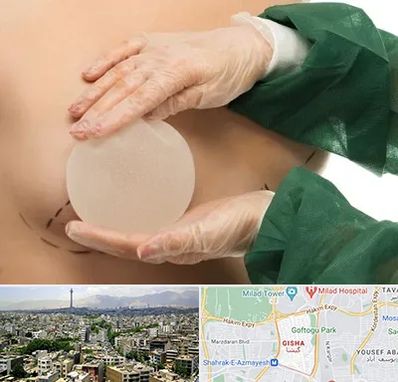 جراحی پروتز سینه در گیشا