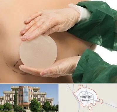 جراحی پروتز سینه در دهدشت
