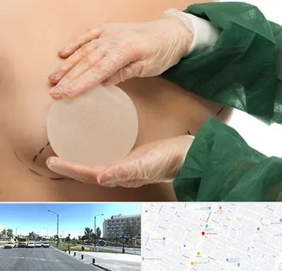 جراحی پروتز سینه در بلوار کلاهدوز مشهد