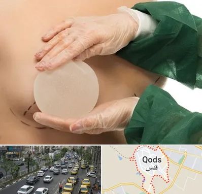 جراحی پروتز سینه در شهر قدس