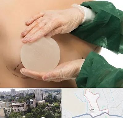 جراحی پروتز سینه در اوین