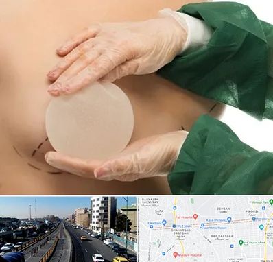 جراحی پروتز سینه در پیروزی