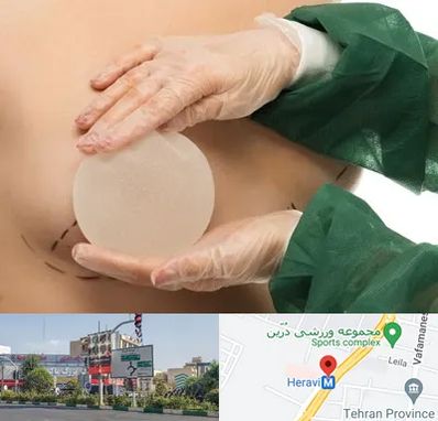 جراحی پروتز سینه در هروی