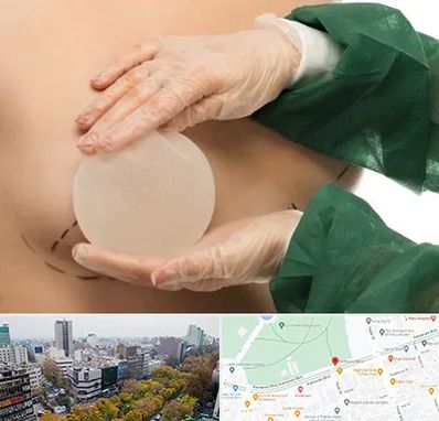 جراحی پروتز سینه در بلوار کشاورز