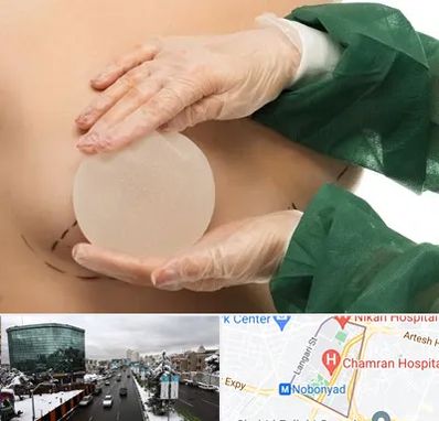 جراحی پروتز سینه در اقدسیه