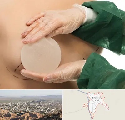 جراحی پروتز سینه در اسفراین
