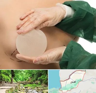 جراحی پروتز سینه در گلستان