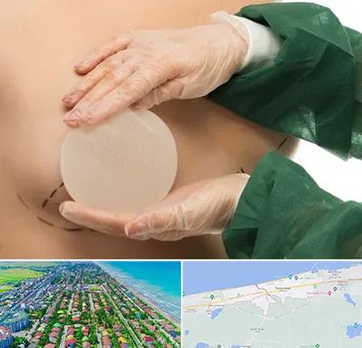 جراحی پروتز سینه در فریدونکنار