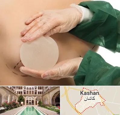 جراحی پروتز سینه در کاشان