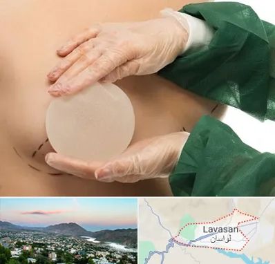 جراحی پروتز سینه در لواسان