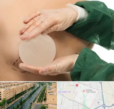 جراحی پروتز سینه در فاز سه اندیشه