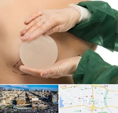 جراحی پروتز سینه در شهرک راه آهن