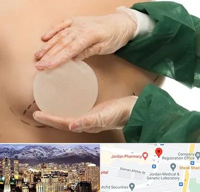 جراحی پروتز سینه در جردن