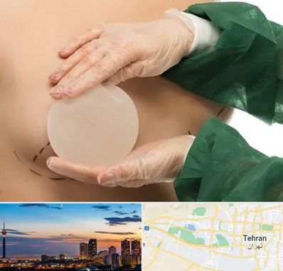 جراحی پروتز سینه در غرب تهران