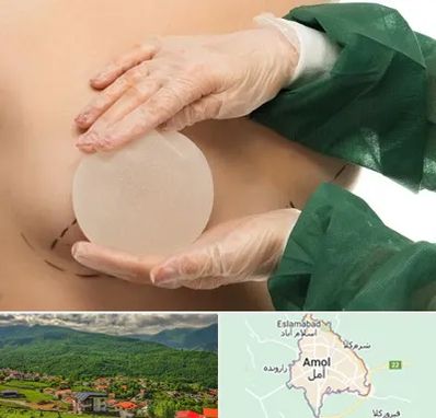 جراحی پروتز سینه در آمل