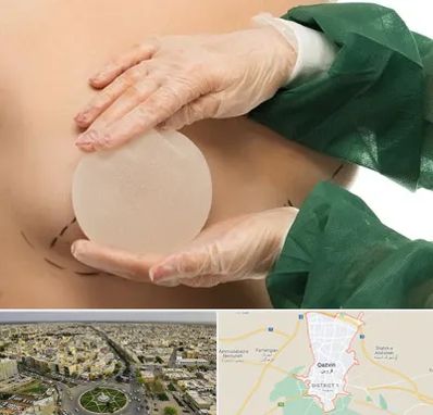 جراحی پروتز سینه در قزوین