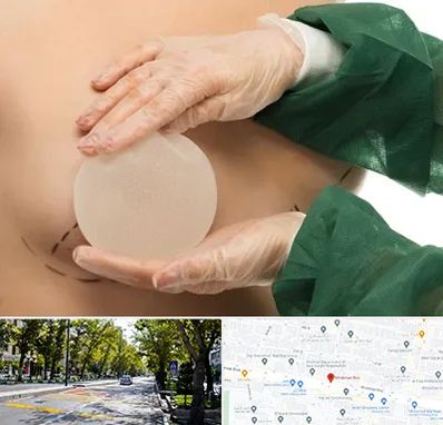 جراحی پروتز سینه در میرداماد