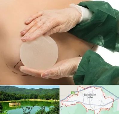 جراحی پروتز سینه در بهشهر
