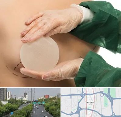 جراحی پروتز سینه در توانیر