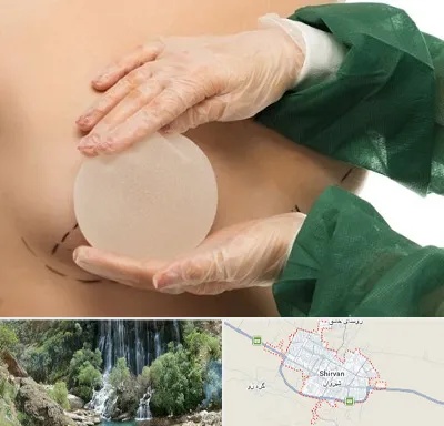 جراحی پروتز سینه در شیروان
