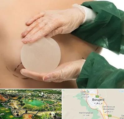 جراحی پروتز سینه در بروجرد