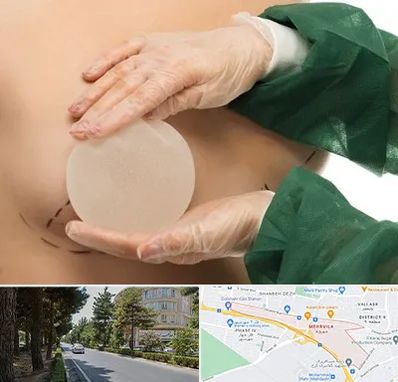 جراحی پروتز سینه در مهرویلا کرج