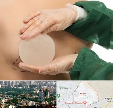 جراحی پروتز سینه در عظیمیه کرج