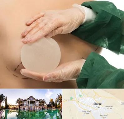 جراحی پروتز سینه در شیراز