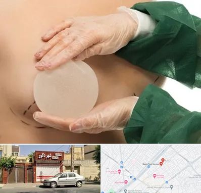 جراحی پروتز سینه در باجک قم