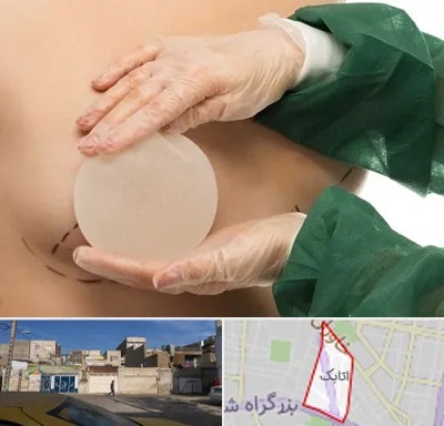 جراحی پروتز سینه در اتابک