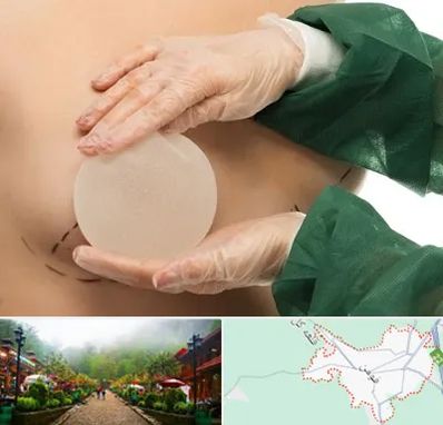 جراحی پروتز سینه در فومن