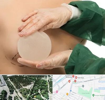 جراحی پروتز سینه در سالاریه قم