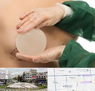 جراحی پروتز سینه در مرکز تهران