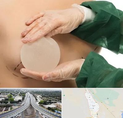 جراحی پروتز سینه در اندیمشک