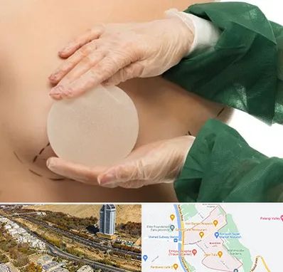 جراحی پروتز سینه در خیابان نیایش شیراز