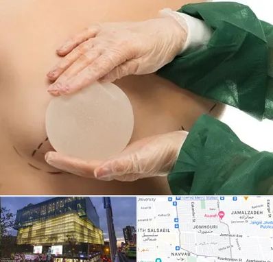 جراحی پروتز سینه در جمهوری