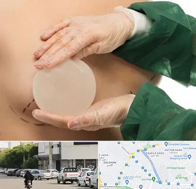 جراحی پروتز سینه در قدوسی شرقی شیراز