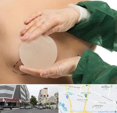 جراحی پروتز سینه در بلوار فردوس