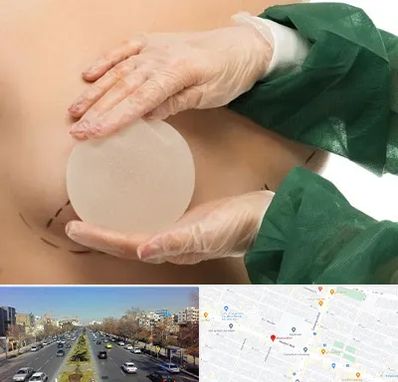 جراحی پروتز سینه در بلوار معلم مشهد