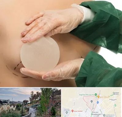 جراحی پروتز سینه در باغستان کرج