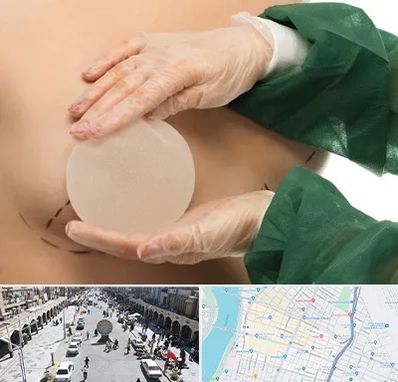 جراحی پروتز سینه در نادری اهواز