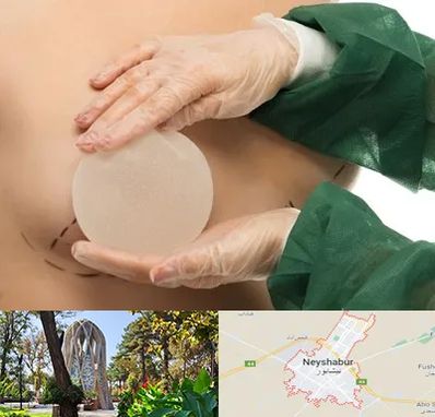 جراحی پروتز سینه در نیشابور