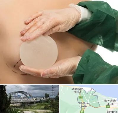 جراحی پروتز سینه در چالوس