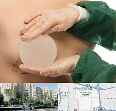 جراحی پروتز سینه در آپادانا