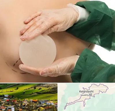 جراحی پروتز سینه در کلاردشت