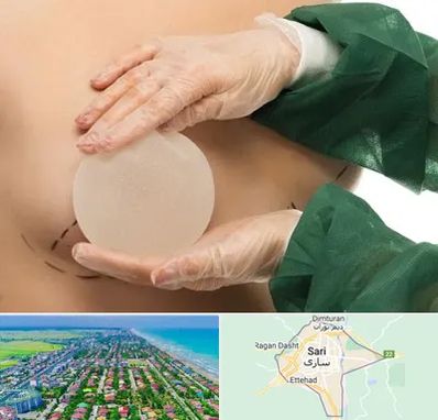 جراحی پروتز سینه در ساری