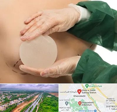 جراحی پروتز سینه در قصرالدشت شیراز