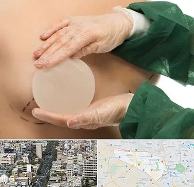 جراحی پروتز سینه در منطقه 18 تهران